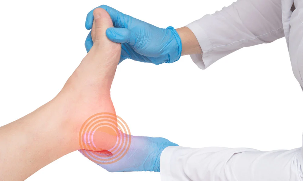Get Proper Heel Spur Treatment to Reduce Foot Pain: Amit Shah DPM:  Podiatrists