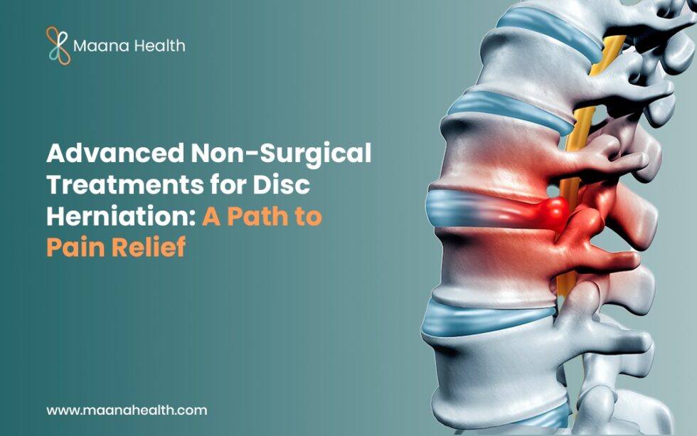 Advanced Non-Surgical Treatments for Disc Herniation: A Path to Pain ...
